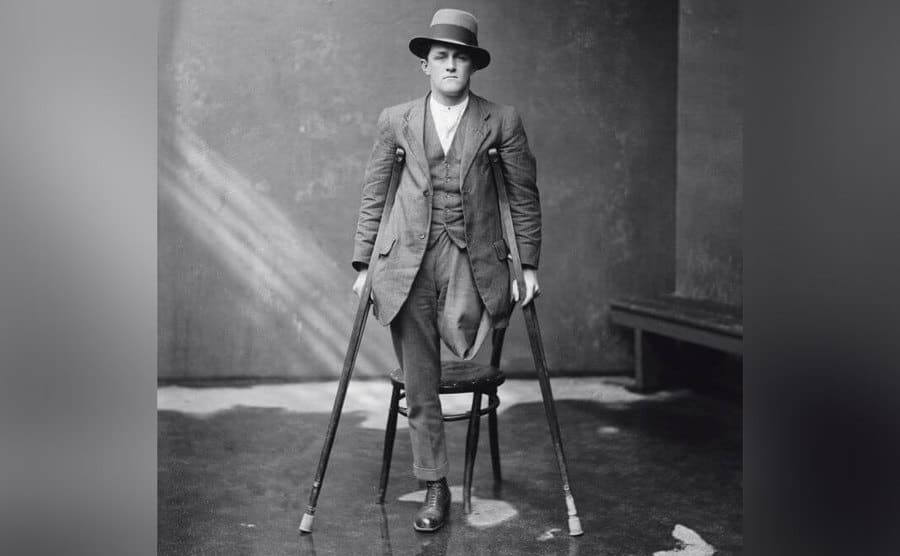 A man with an amputated leg stands on crutches. 